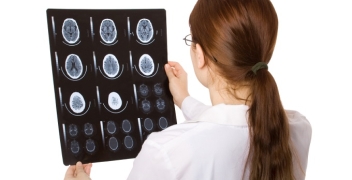 Unique Characteristics of Assault-Related Concussions